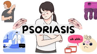 PSORIASIS supersimplified like never before  Dermatology  Med Vids Made Simple [upl. by Htebazileyram885]