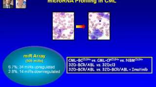 miRNA Decoy in Tumor Suppression [upl. by Hinkel]