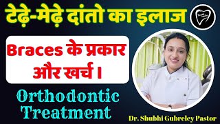 टेढ़ेमेड़े दांतो का इलाज।।types of Braces।।orthodontic treatment।। braces cost [upl. by Feetal46]