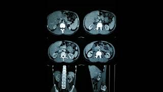 RADIOLOGY EXAM CASES [upl. by Tteragram888]