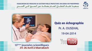 Quiz en échographie Pr A OUSEHAL [upl. by Algernon340]