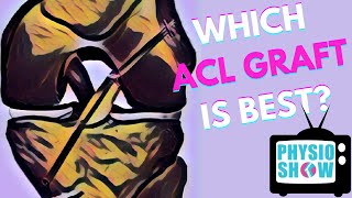 Which ACL Graft Is Best For Returning to Sport [upl. by Poll]