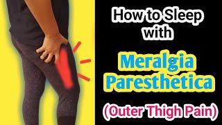 Tips to get relief from Meralgia Paresthetica  Selfcare tips  Outer thigh pain [upl. by Acker]