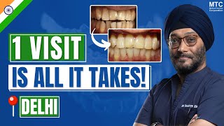 Invisalign in Delhi India Your 4Minute Guide To A Straighter Smile [upl. by Emeline488]