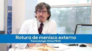 Rotura de menisco externo  Traumatología Clínica MEDS [upl. by Dole]