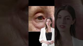 Why is your eyelid twitching EyelidTwitching Myokymia HealthTips GlucoFlixquot [upl. by Jacobine]