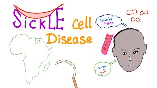 Sickle Cell Disease “Part 1” Intro [upl. by Ellened]