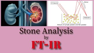 Stone analysis by FTIR  Kidney Stone  Gallbladder stone  Salivary duct stone  Chemical analysis [upl. by Addiel]