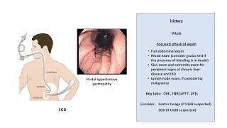 An Approach to GI Bleeding Melena Hematemesis Hematochezia [upl. by Scoville529]