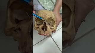 NORMA FRONTALIS ANATOMY MODEL SKUL medicitis skullanatomy normafrontalis [upl. by Bartie]