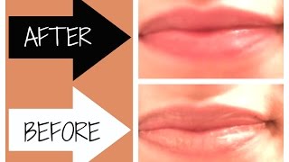 How To Fix Chapped Lips Fast [upl. by Hakan]