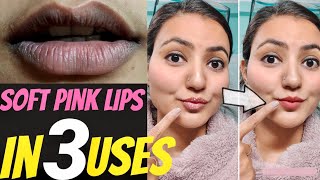 The BEST and WORST Lip Balms for your chapped lips according to a Dermatologist [upl. by Marijn]