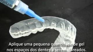 Clareamento Dental Caseiro Whiteness Perfect  Passo a Passo  Bonati Company [upl. by Fast70]