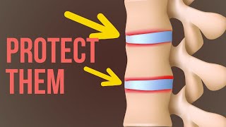 5 Effective Tips To Keep Intervertebral Discs Healthy [upl. by Airdnal]