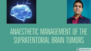 Anesthetic management of the Supratentorial brain tumors [upl. by Notsnorb]