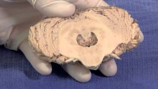 The Cerebellum Neuroanatomy Video Lab  Brain Dissections [upl. by Ilocin]