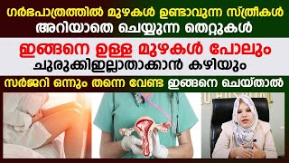 ഗർഭപാത്രത്തിൽ മുഴകളുള്ള സ്ത്രീകൾക്ക് സർജറി ഇല്ലാതെ ഗർഭപാത്രത്തിലെ മുഴകൾ ചുരുക്കി ഇല്ലാതാക്കാം [upl. by Mackie879]