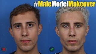 NYC Male Model Makeover with Facial Filler by Dr Steinbrech 6 [upl. by Annaitat]