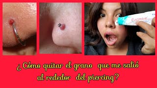 ¿Cómo quitar granobultoqueloide que me salió al rededor del piercing [upl. by Linetta]