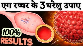 एग रप्चर के 3 घरेलू उपाय करिए प्रेगनेंसी ज़रूर होगी  Egg rupture tips  Youtube Saheli [upl. by Ziguard]