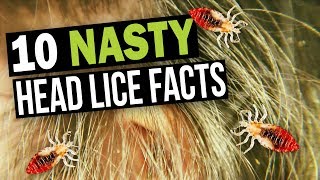 10 Facts You Dont Want to Know about Head Lice [upl. by Lela388]