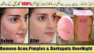 Acne cream  Blesso acne pimple dark spots remove cream  with vitamin E uv protector [upl. by Capone519]