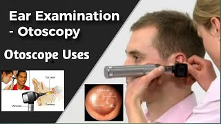 Ear Examination and Otoscopy How To Use  How To Purchase Otoscope Device Otoscope ke fyde [upl. by Herminia]