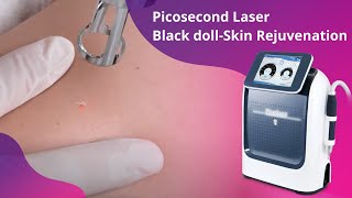 Pro Mole Removal Picosecond Laser Skin Whitening Machine [upl. by Tyson]