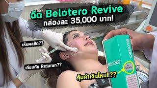 ทำ Belotero Revive ครั้งแรก เทียบกับ Rejuran ผ่านไป 14 วัน หน้าใสขนาดไหน  แม่หนูปากแดง EP 215 [upl. by Rugen]