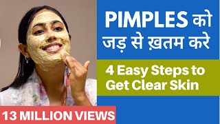 satisfying acne blackhead removal relaxing video5 [upl. by Utica]