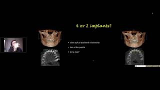 TRI® OnlineWebinar with Dr Torsten Kamm 02112016 [upl. by Tneicniv]