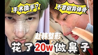 【川大发】三年三次鼻修复！光是鼻子就花了20w！我的鼻整形心路历程｜手术换手｜赴韩整形｜ [upl. by Aubreir568]