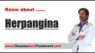 Herpangina  Causes Diagnosis Symptoms Treatment [upl. by Ahsieyn]