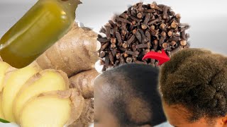 I used GINGER AND CLOVES in my hair then this happenedCLOVES and GINGER for Hair growth [upl. by Pearla960]