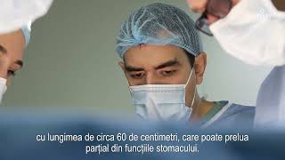 Gastrectomie radicală totală în cancerul gastric – Dr Cezar Stroescu [upl. by Attiuqal]