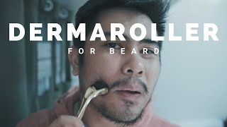 Minoxidil for Beard Growth Week 3 Derma Roller for Beard [upl. by Hortensa]