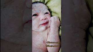 Newborn with vernix caseosababyshorts babyvideos newbornbaby [upl. by Arrimat186]