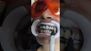 White teeth  Dontia Dental Care  Best Dental Clinic in Kolkata for teeth whitening dentist yt [upl. by Amian]