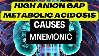 High Anion Gap Metabolic Acidosis HAGMA Causes  Easy Mnemonics [upl. by Kailey33]