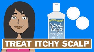 How To Clean Your Scalp With Witch Hazel [upl. by Ulita]