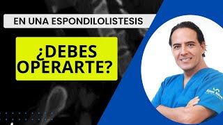 ESPONDILOLISTESIS ¿DEBES OPERARTE [upl. by Llenrrad929]