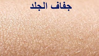 جفاف الجلد Xerosis  الأعراض والأسباب والعلاج [upl. by Drucie]