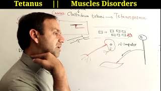 Tetanus  Causes symptoms Complications and treatment of tetanus class 12 Biology [upl. by Luane]