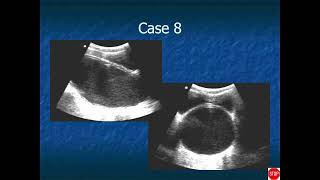 RADIOLOGY EXAM CASES [upl. by Solana]