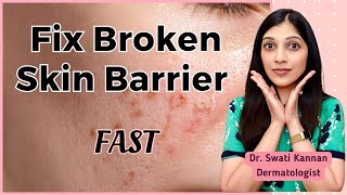 Fix Your Broken Skin Barrier Fast Proven Dermatologist Secrets [upl. by Rosenstein]