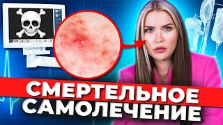 ОПАСНЫЕ ПРЫЩИ ⚠️ Смертельные капельницы красоты [upl. by Esilenna]