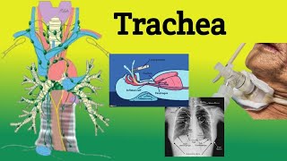 Trachea  Anatomy Location Relations Clinical Correlations [upl. by Oigile180]