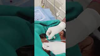 Central line insert video  internal jugular cathetrization  how to central line procedure video [upl. by Eninnej]