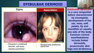 OCULAR NEOPLASMS [upl. by Elleirad]