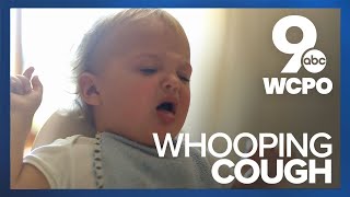 Sound of whooping cough [upl. by Naquin]